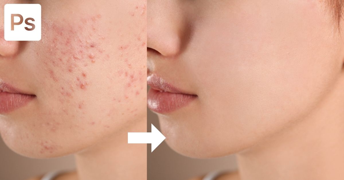 How To Remove Blemishes In Photoshop (3 Easy Ways)