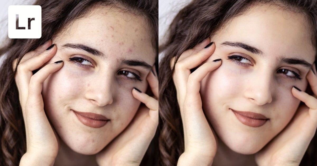 How To Remove Blemishes And Soften Skin in Lightroom